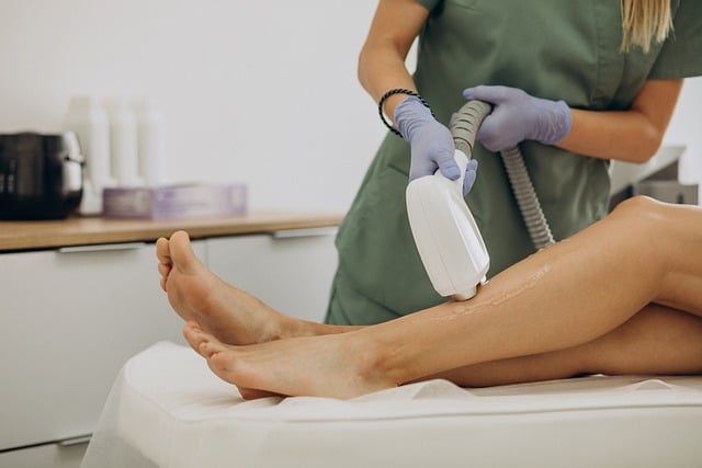 laser treatment for dark spots